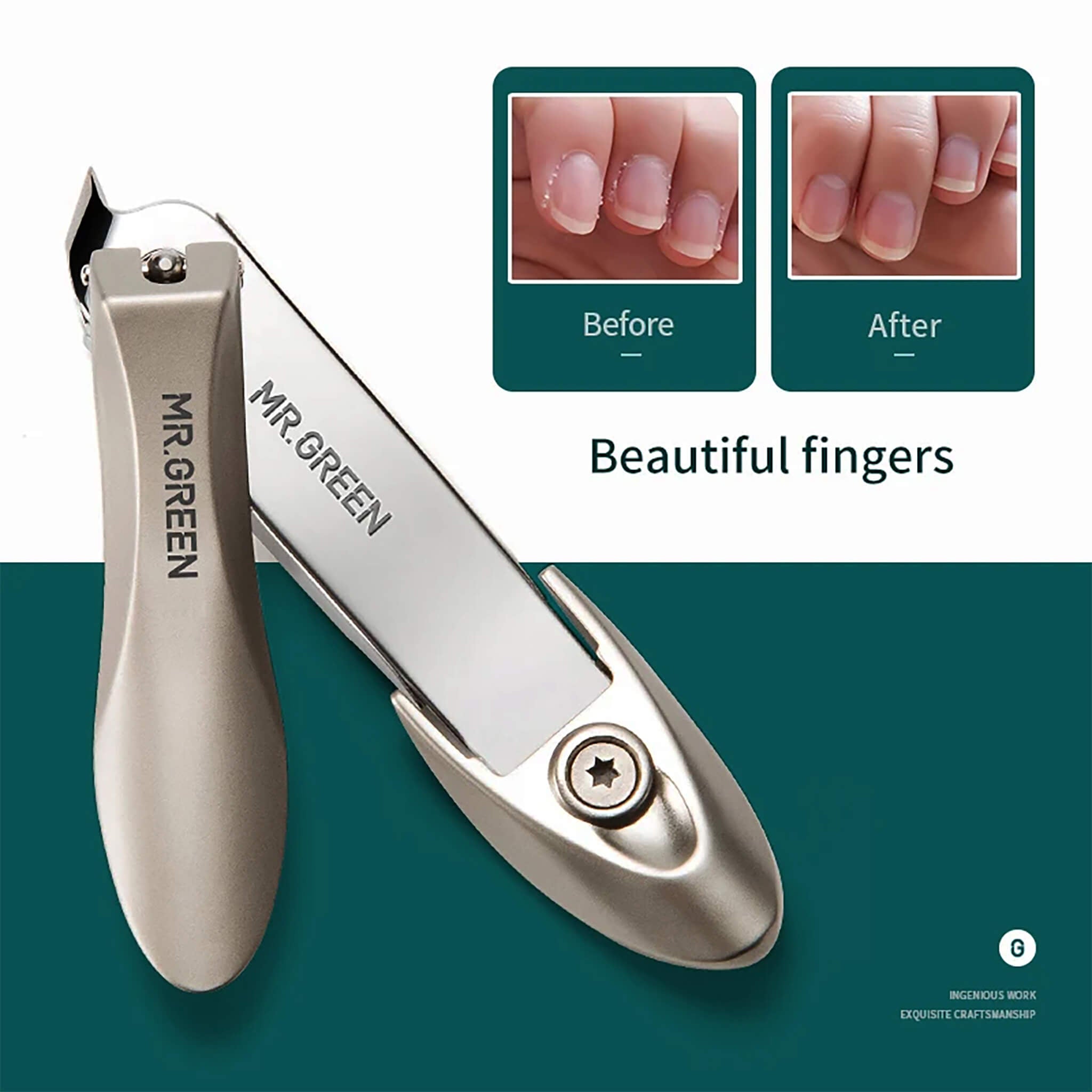 Cortaúñas MR.GREEN de filo oblicuo con canal anti-salpicaduras y mango ergonómico; resultados de uñas antes y después
