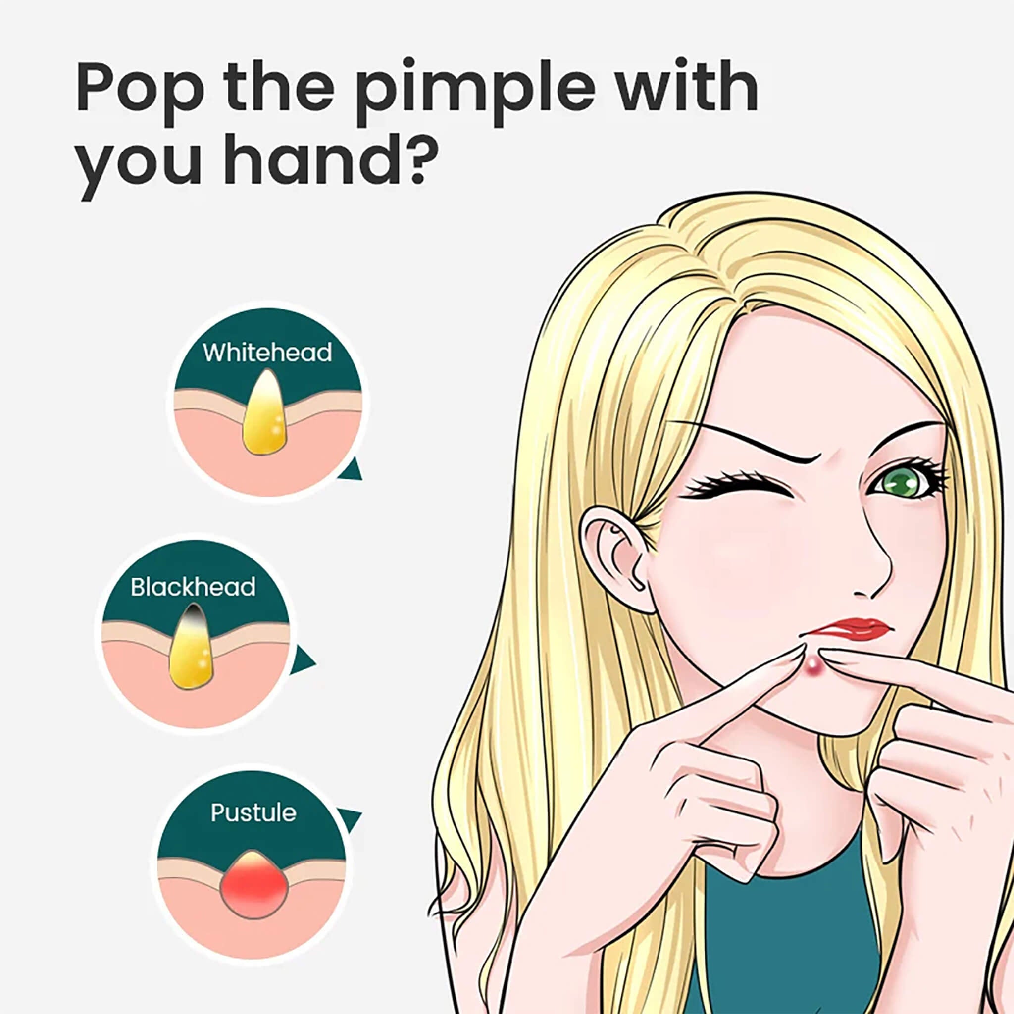 Ilustración: no revientes granos con los dedos; whitehead, blackhead y pústula; usa extractor higiénico MR.GREEN.