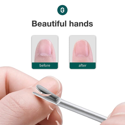 Removedor de piel muerta MR.GREEN con punta en V; comparación antes/después, mango antideslizante y control seguro en manicura.